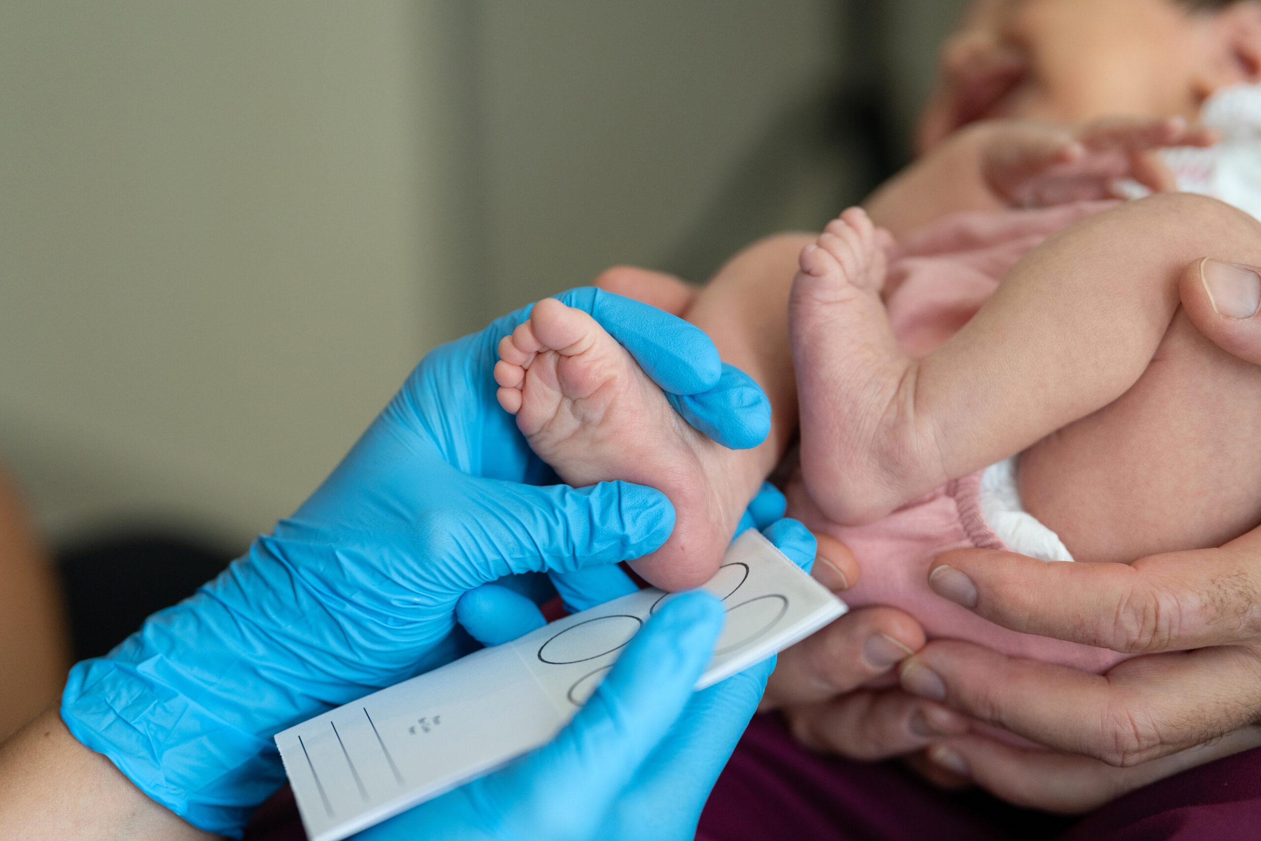 Healthcare professional in blue gloves examining a newborn's foot for early signs of orthopedic deformities, highlighting the importance of pediatric musculoskeletal screening and early intervention."