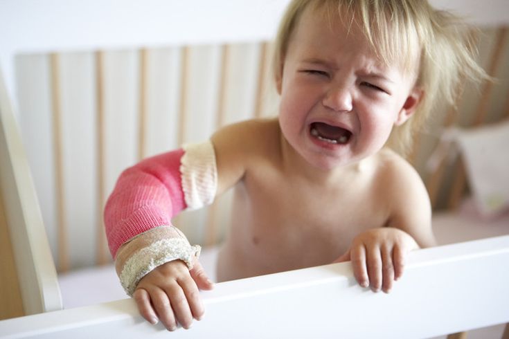 Child holding injured arm, showing signs of a suspected fracture