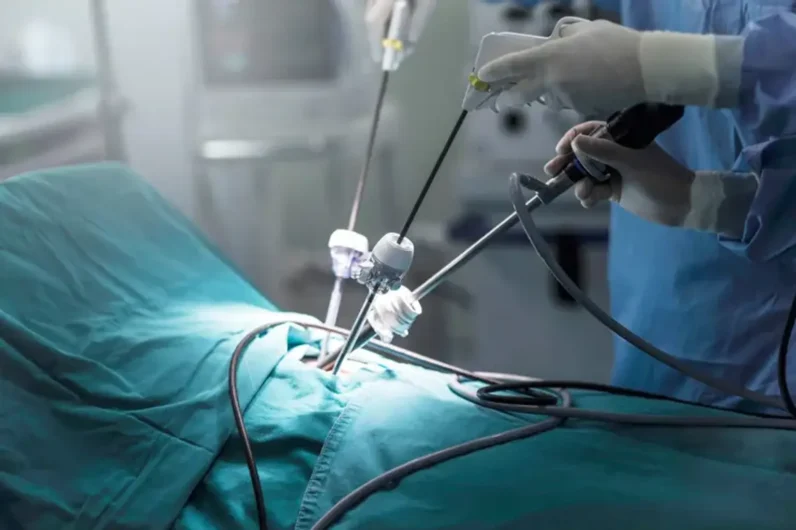 Laparoscopic gynecological surgery being performed in a modern operation theatre