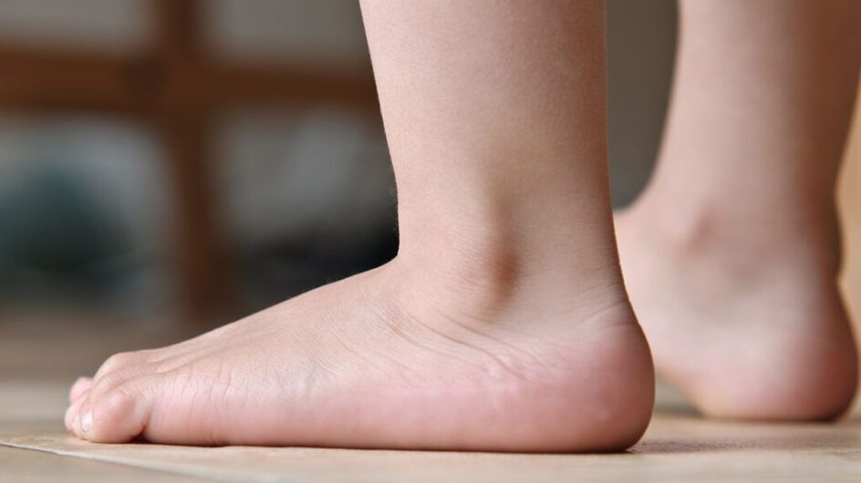 Child standing with flat feet while a parent observes foot development and posture.